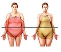 Динамика антропометрических показателей у женщин фертильного возраста с ожирением при различных схемах терапии