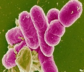 Clinical significance of prostaglandins in form of courses of bacterial intestinal infections in children