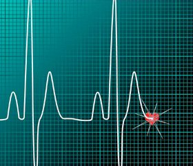 Діабетична кардіальна автономна нейропатія: які перспективи в лікуванні?