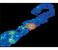 Proteomics and Matrix-Assisted Laser Desorption/Ionization Mass Spectrometry Imaging as a Modern Diagnostic Tool in Kidney Diseases