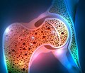 Частота і структура основних чинників ризику у жінок із постменопаузним остеопорозом