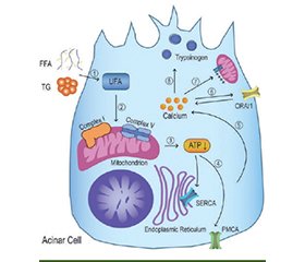 Внутрішньоклітинний кальцій у підшлунковій залозі. Частина 2. Роль при гострому панкреатиті