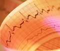 Частота серцевих скорочень та артеріальна гіпертензія: вплив на смертність та захворюваність